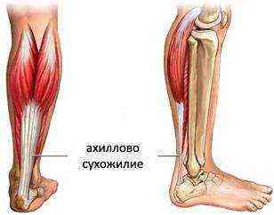 чем лечить воспаление пятки ахиллесова пята после сильнейшего вывиха