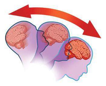 что делать если ты ушиб голову и тебя тошнит