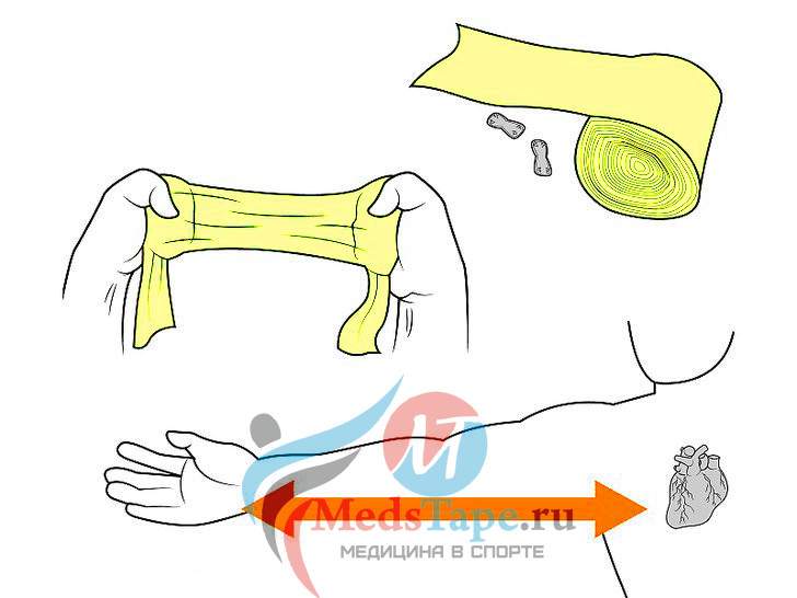как правильно наматывать эластичный бинт на руку при ушибе