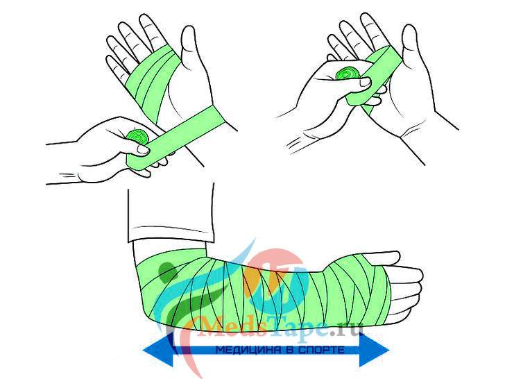 как правильно наматывать эластичный бинт на руку при ушибе