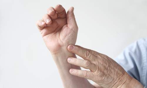 как вылечить вывих руки в домашних условиях без боли