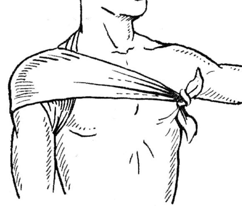 как зафиксировать плечевой сустав эластичным бинтом при переднем вывихе