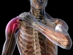 комплекс лфк при вывихе плечевого сустава