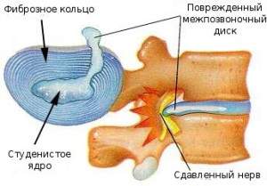 могут ли быть отеки под глазами при остеохондрозе шейного отдела