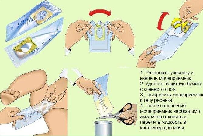 можно ли делать компресс из мочи при ушибе