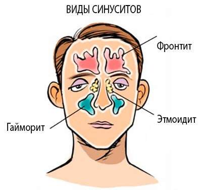 можно ли греть нос при отеке слизистой носа у ребенка