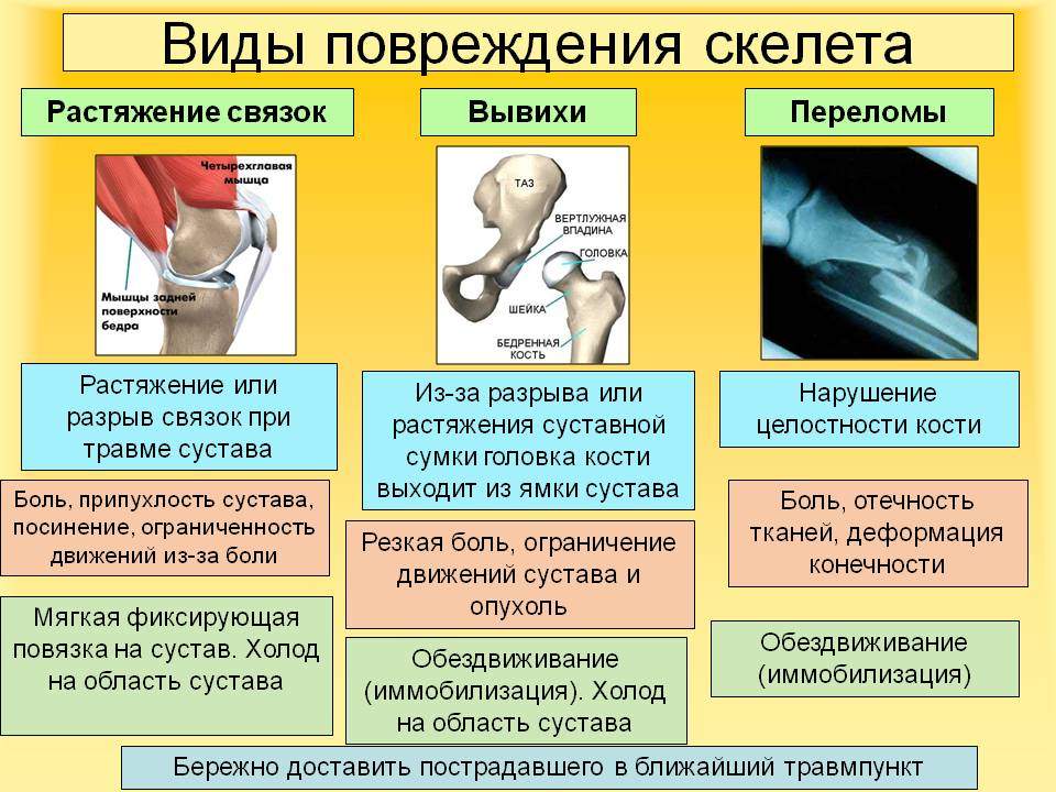 можно ли вправлять вывих пострадавшему при оказании первой помощи