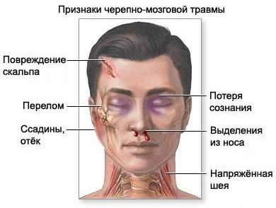 оказание первой медицинской помощи при травмах и ушибах