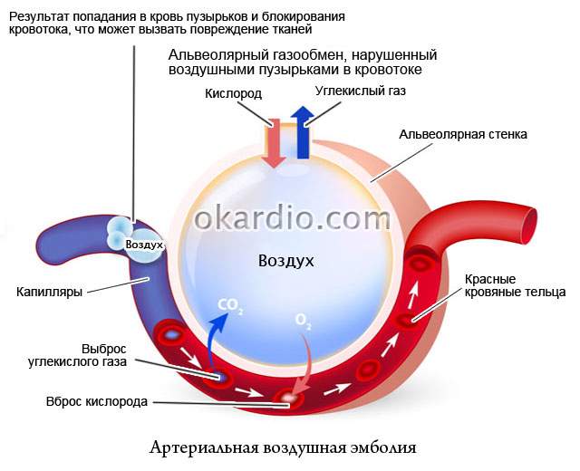 опасность венозного кровотечения 1 отеки 2 воздушная эмболия 3 гипертония