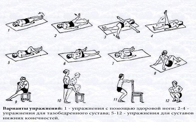 особенности реабилитации больных при переломе верхних конечностей