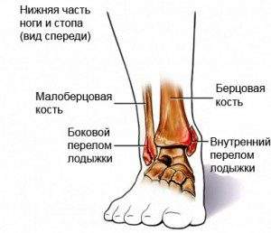 отек голеностопа на одной ноге причины без болевого симптома