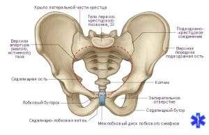 отрывной перелом передней нижней ости подвздошной кости
