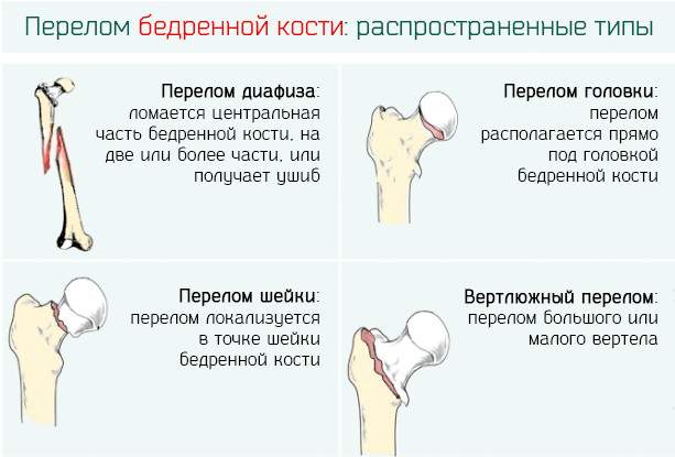 перечислите действия которые необходимо совершить при ушибе бедра