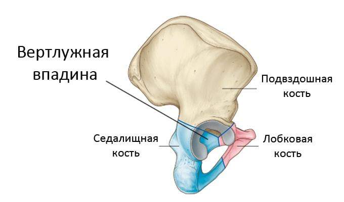 перелом дна вертлужной впадины со смещением отломков