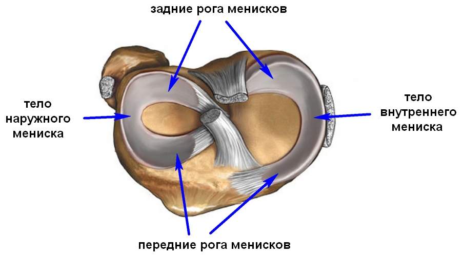 перелом мениска коленного сустава лечение без операции