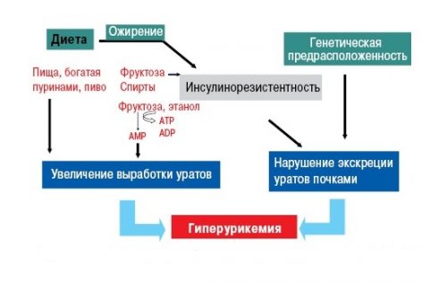 подагра чем снять боль и отек в домашних условиях