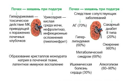 подагра чем снять боль и отек в домашних условиях