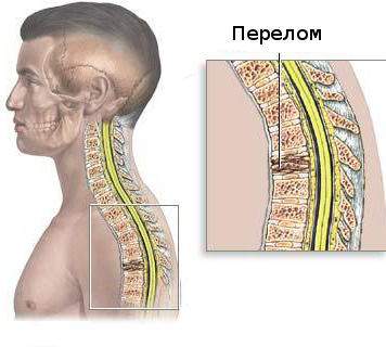 показания к оперативному лечению переломов у детей