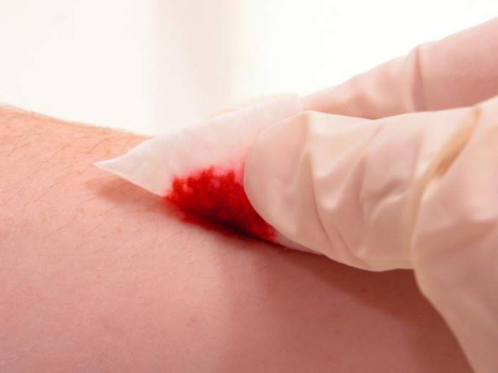 правила оказания первой помощи при травмах ушибах кровотечениях