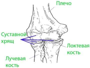 при ушибе локтевого сустава сколько ходить в гипсе