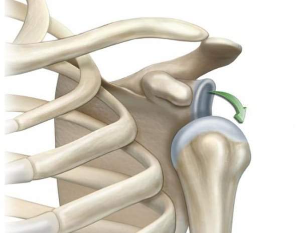 при вывихе плечевого сустава необходимо сразу же