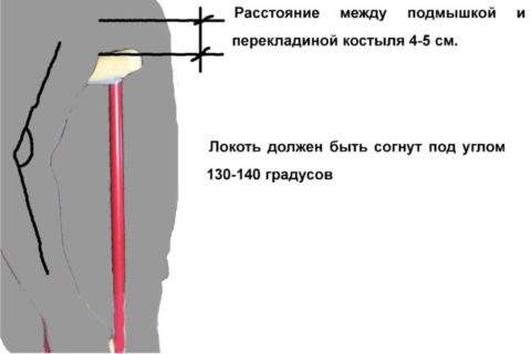 приспособления для ходьбы после перелома шейки бедра