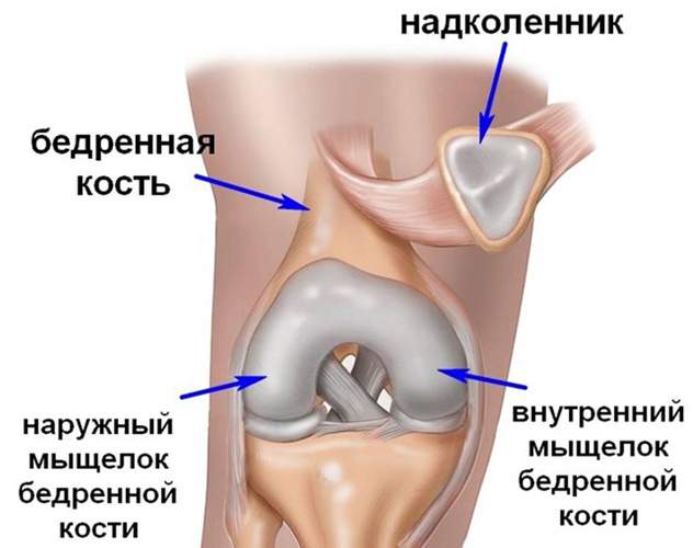 привычный вывих надколенника у ребенка 13 лет