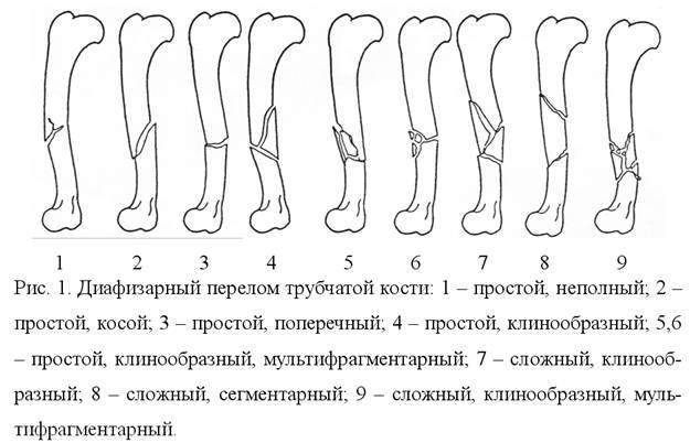 рентгенологические признаки переломов костей абсолютные и относительные