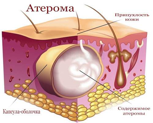 шишка на голове сзади на черепе у ребенка от ушиба