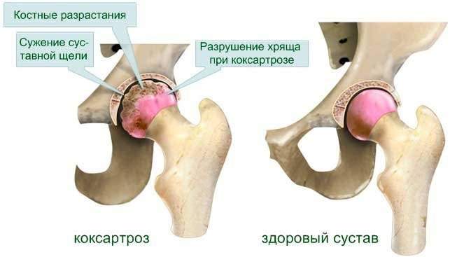 у бабушки отек ноги выше колена с внутренней стороны