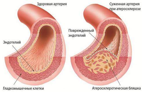 у детей с нарушением кровообращения появление отеков начинается с