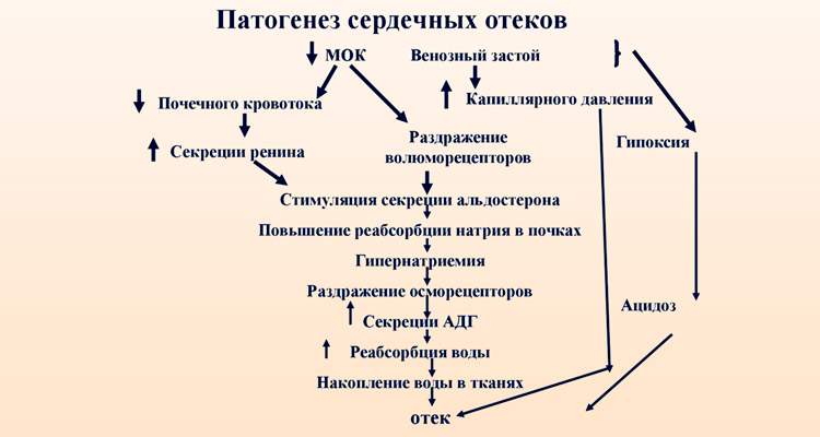 у пациентов с сердечной недостаточностью появление отеков начинается с