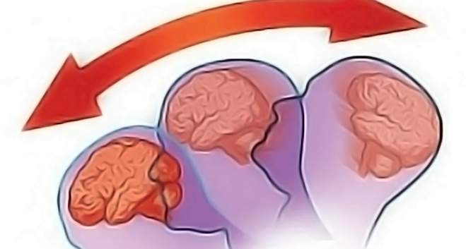 ушиб головного мозга последствия у детей до года