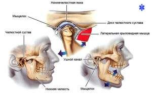 вывих челюсти при зевании лечение народными средствами