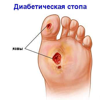 боль и отек в стопе причины и лечение