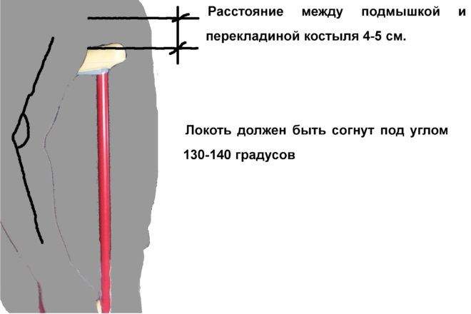 как ходить на костылях при переломе стопы