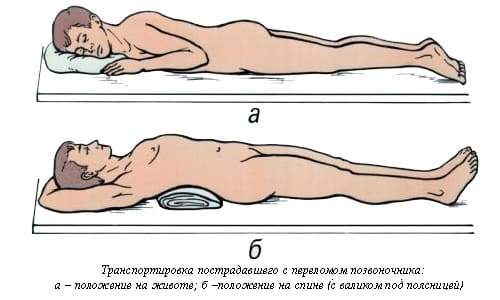 как можно лежать при компрессионном переломе позвоночника