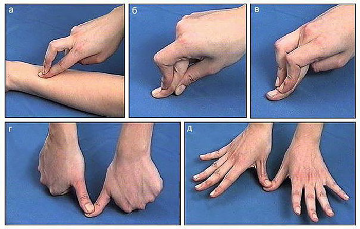 как разрабатывать суставы пальцев рук после перелома