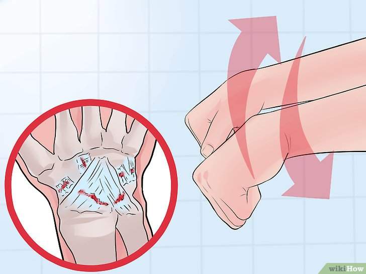 как сделать повязку на руку при ушибе
