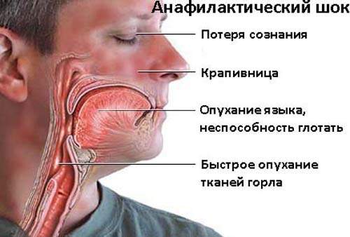 как снять аллергический отек и покраснение на теле