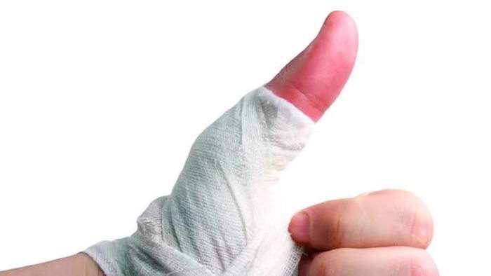 как снять отек с пальцев рук после операции