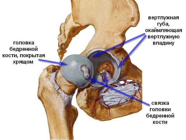 лечение при ушибе тазобедренного сустава народными средствами