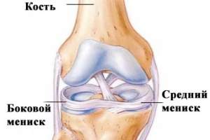 мазь для лечения повреждения мениска и от отека