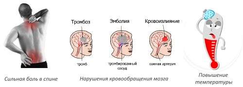 можно ли греть позвоночник при компрессионном переломе