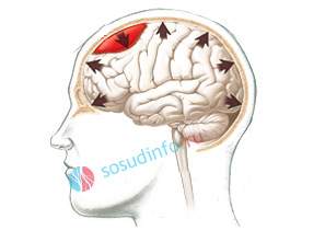 от чего бывает отек мозга у взрослого человека