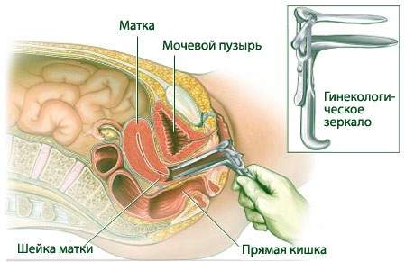 отек и боль наружных половых органов у женщин