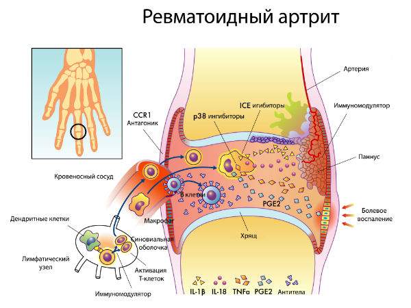 отек пальца на руке к какому врачу идти