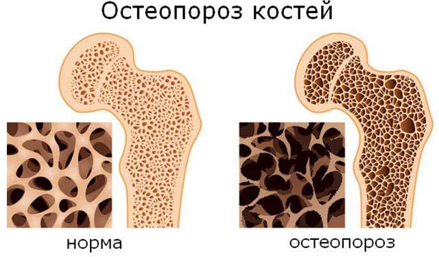 отек палец на ноге без причины и болит