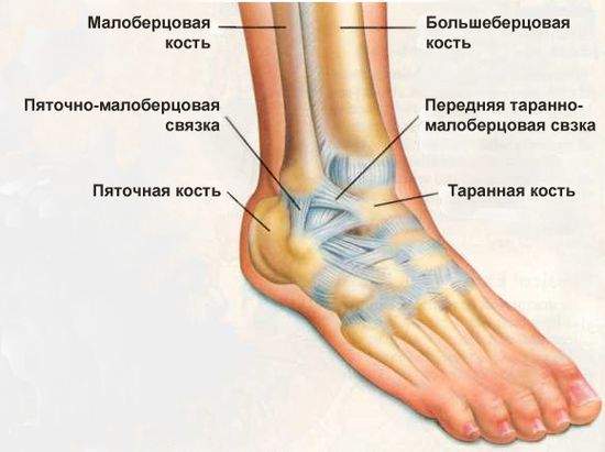 отек при растяжении связок голеностопного сустава после гипса