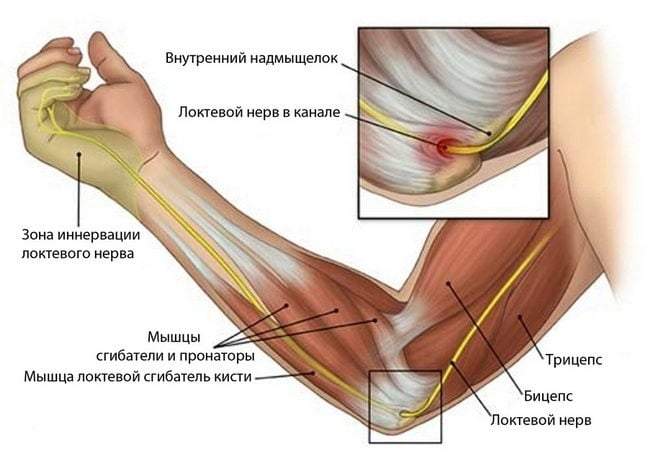 отекла одна рука от локтя до кисти причины